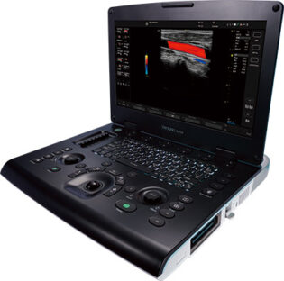 Versana Active ベルサナアクティブ 超音波画像診断装置 GE